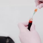 비타민D 부족이 의심될 때 햇빛과 식사만으로 부족해질 수 있는 사람 특징과 검사 전 체크