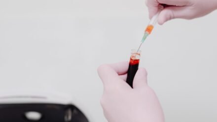 비타민D 부족이 의심될 때 햇빛과 식사만으로 부족해질 수 있는 사람 특징과 검사 전 체크